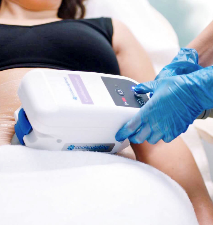 CoolSculpting