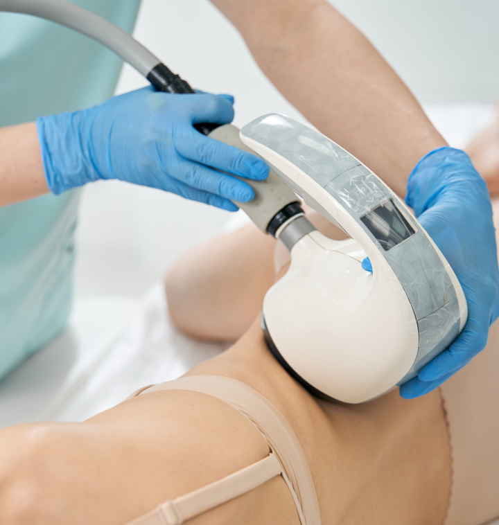 velaShape-3